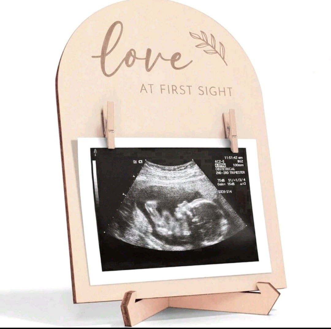 BABY - SCAN DISPLAY